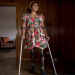 Woman who lost legs in HDP rally bombing wins compensation from Turkish ministry