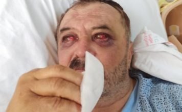 Minister accuses Kurdish villagers allegedly tortured by Turkish soldiers of aiding terrorists: report