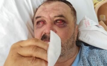 Turkish prosecutor demands 15 years for Kurdish villager who was allegedly beaten by security forces