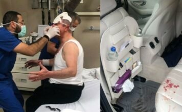 Opposition politician injured in assault in front of his Ankara house: report