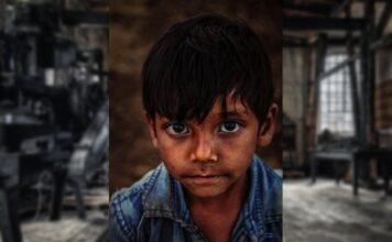 8-year-old refugee boy hospitalized after leg is mangled at work