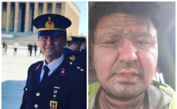 Dismissed officer severely injured in workplace accident