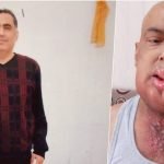 Former teacher imprisoned on Gülen charges dies of cancer after belated release from prison