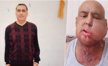 Former teacher imprisoned on Gülen charges dies of cancer after belated release from prison