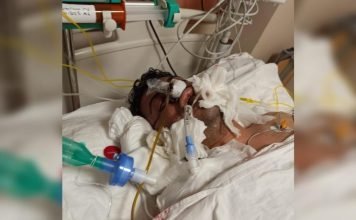 Images of inmate who died in Silivri Prison show signs of severe beating and mistreatment
