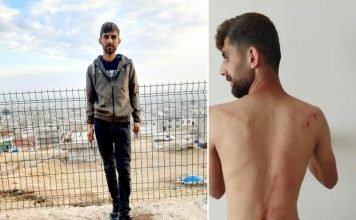 Worker for gov’t housing agency claims construction site authorities beat him for refusing to put in more overtime