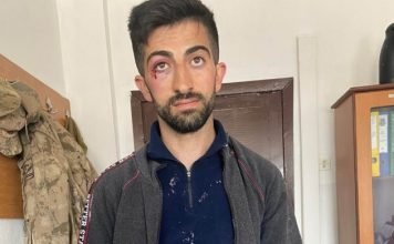 Kurdish man claims he was severely beaten by gendarmes in eastern Turkey