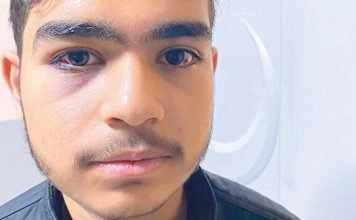 3 Jordanian teenagers beaten in Istanbul in apparent hate crime