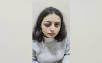 HEDEP youth member physically assaulted by police