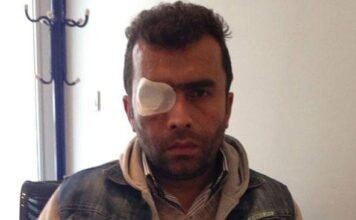 Municipal employee who lost his eye due to Gezi Park police violence awarded $3,000 in damages