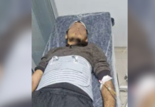 Man jailed after alleged beating in Turkish custody taken to hospital with brain hemorrhage risk