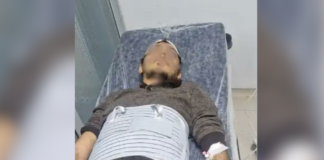 Man jailed after alleged beating in Turkish custody taken to hospital with brain hemorrhage risk