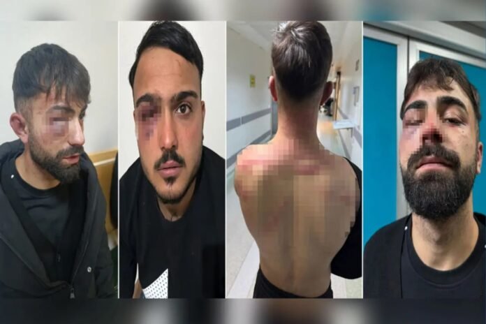 Kurdish workers mistreated