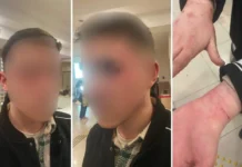 Turkish prosecutors open probe after 19-year-old alleges torture at Istanbul police station