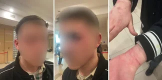 Turkish prosecutors open probe after 19-year-old alleges torture at Istanbul police station