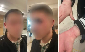 Turkish prosecutors open probe after 19-year-old alleges torture at Istanbul police station