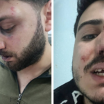 Police accused of beating 3 brothers after traffic dispute in eastern Turkey