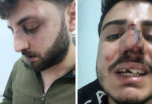 Police accused of beating 3 brothers after traffic dispute in eastern Turkey