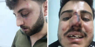 Police accused of beating 3 brothers after traffic dispute in eastern Turkey