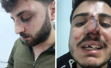 Police accused of beating 3 brothers after traffic dispute in eastern Turkey