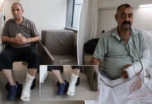 Kurdish shopkeepers hospitalized after alleged racist mob attack in Istanbul
