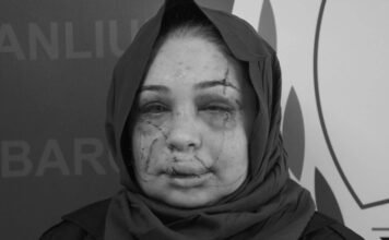 Turkish court reduces sentence of police officer who attacked and injured wife