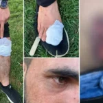 9 Kurdish farmworkers injured in attack in western Turkey allegedly sparked by Amedspor jerseys