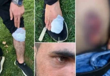 9 Kurdish farmworkers injured in attack in western Turkey allegedly sparked by Amedspor jerseys