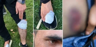 9 Kurdish farmworkers injured in attack in western Turkey allegedly sparked by Amedspor jerseys
