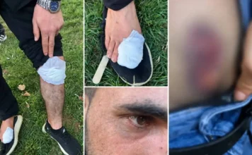 9 Kurdish farmworkers injured in attack in western Turkey allegedly sparked by Amedspor jerseys